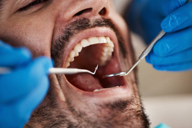 Best Knocked-Out Tooth Emergency  in Brickerville, PA